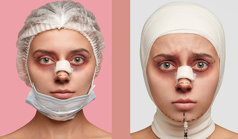 مکمل طبیعی رفع کبودی و خون مردگی بدن